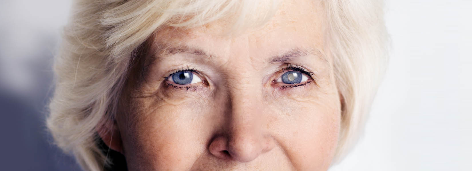Cataract Surgery in Battle Ground